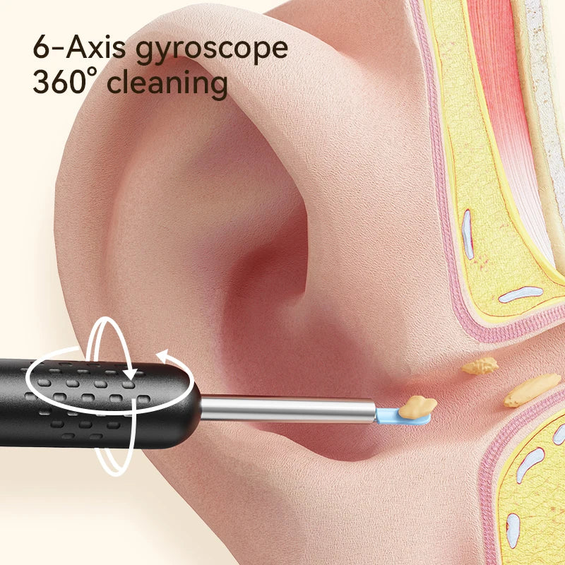 Ear Wax Removal Tool Camera 8M HD Camera and 6 LED Lights Ear Cleaner with Camera Endoscope Ear Cleaning kit for Adult and Child
